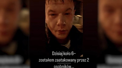 Polski youtuber, Natan Marcon został pobity. „Sprawa jest załatwiana w inny sposób”, niż policja