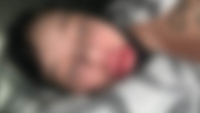 Fagata, polska youtuberka pokazała zdjęcia po operacji. Internet: „Coś poszło bardzo nie tak”